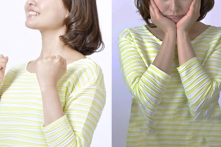 双極性障害のイメージ画像